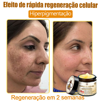 🌿🔥 𝑻𝑳𝑶𝑷𝑨® Creme de Tratamento da Pele com Veneno de Abelha (👨‍⚕️ Com Certificação CE) 👍✅