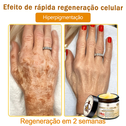 🌿🔥 𝑻𝑳𝑶𝑷𝑨® Creme de Tratamento da Pele com Veneno de Abelha (👨‍⚕️ Com Certificação CE) 👍✅