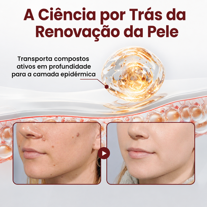 🌿🔥𝑫𝑨𝑨𝑴𝒀® KeraErase Creme Renovador de Dupla Ação